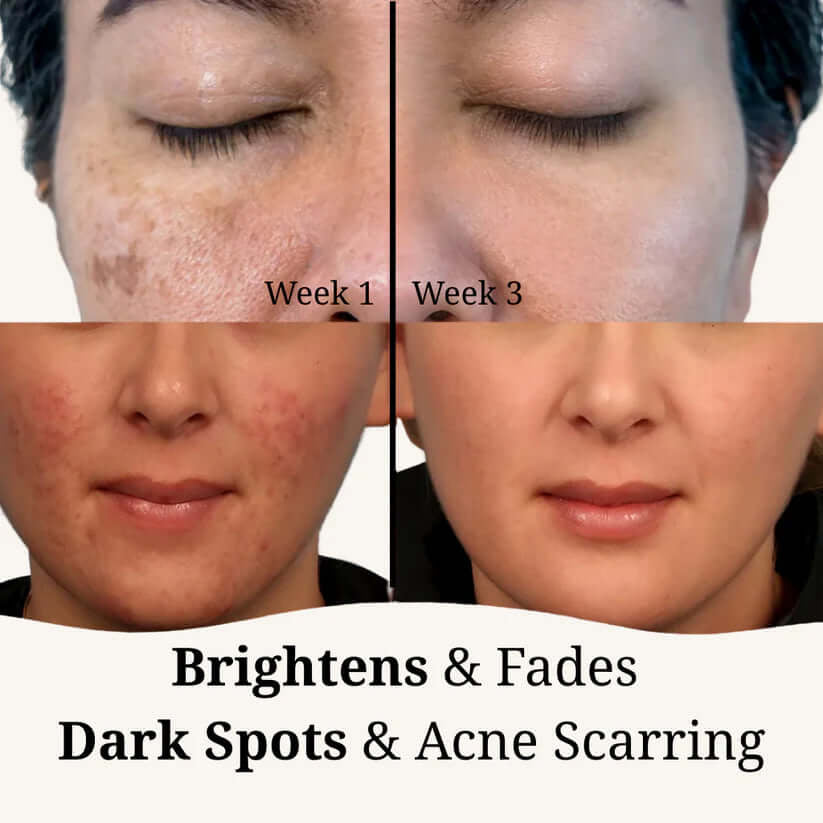 Brightening turmeric & kojic pads